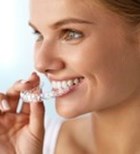 ליישר שיניים - השיטה השקופה